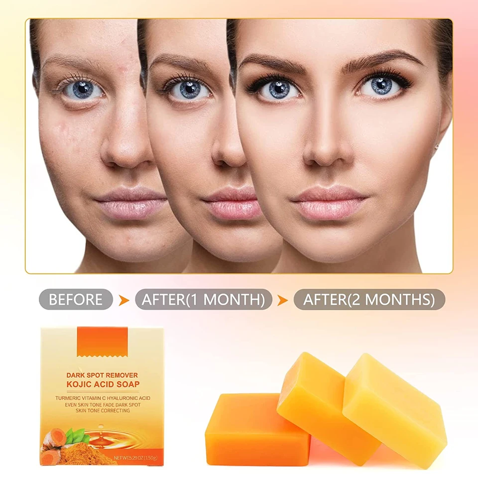 Kojic Acid Soap